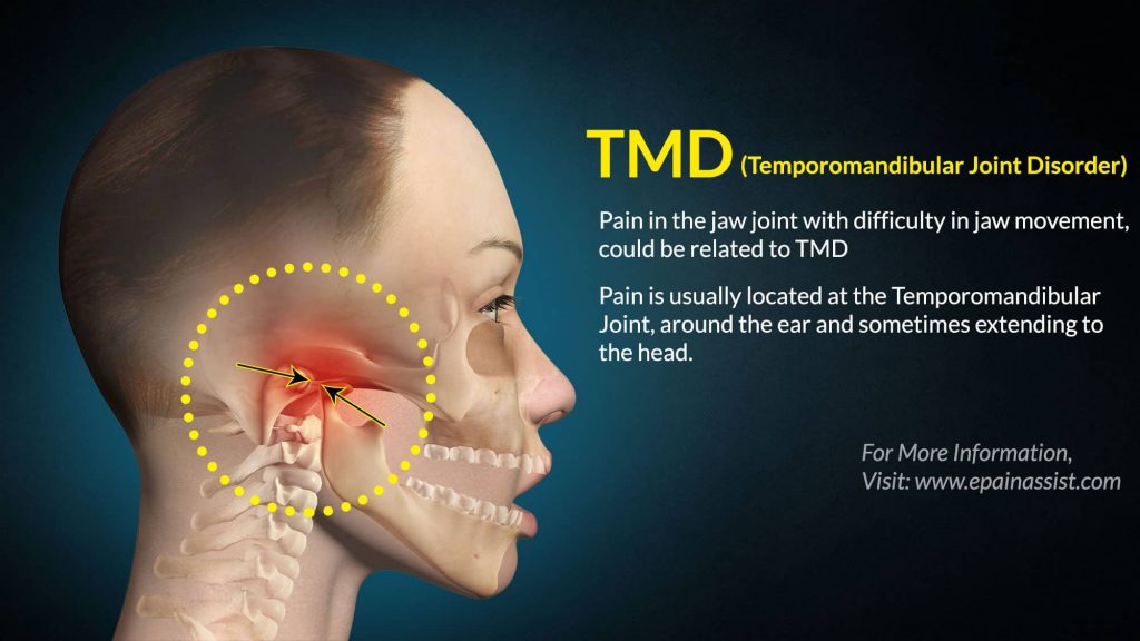 Acupuncture and Temporomandibular Disorder