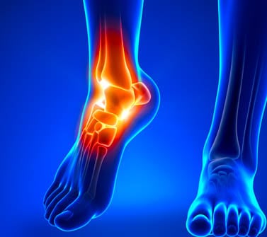 Sprained Ankle & Acupuncture Therapy