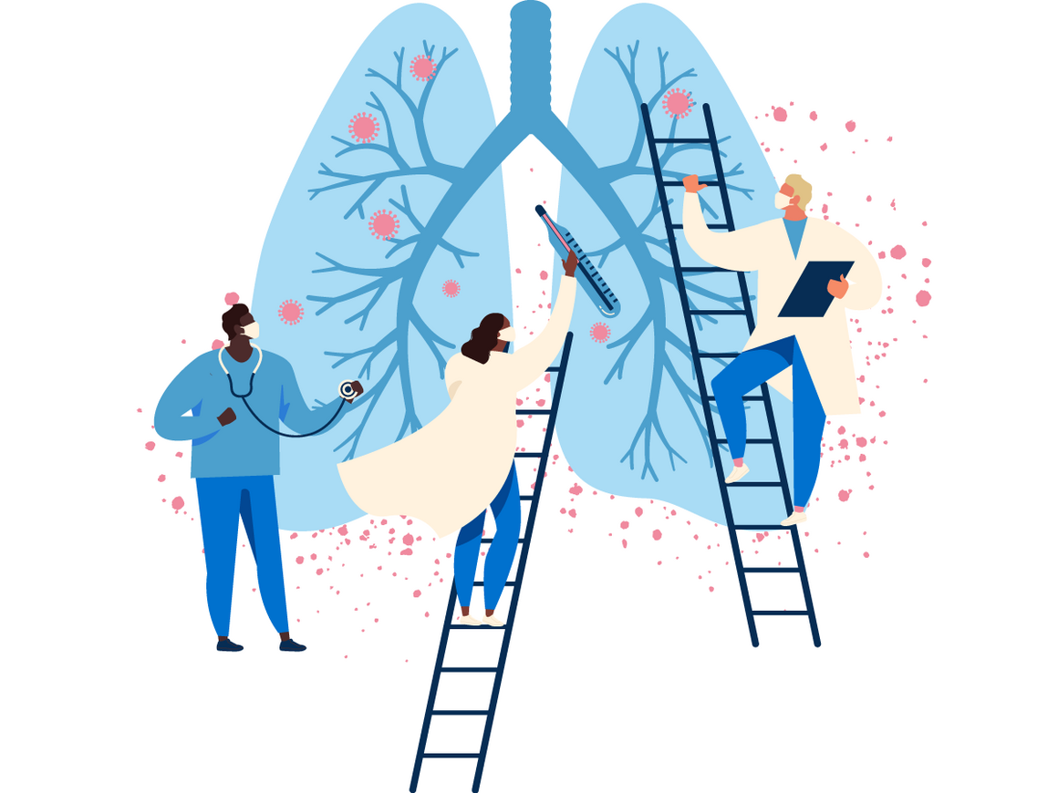 sequelae of Covid-19-lungs are pulmonary fibrosis