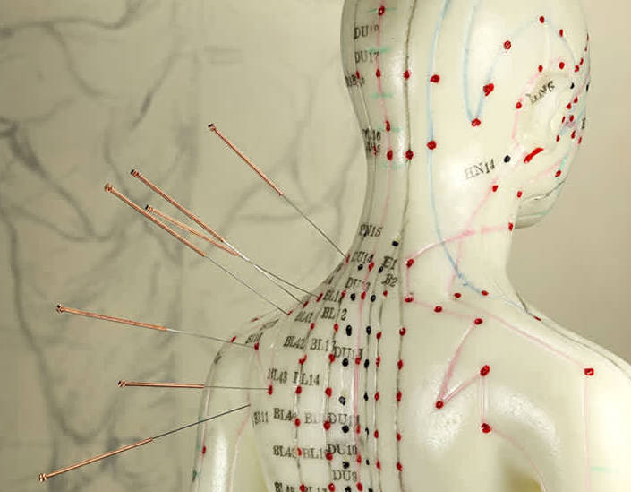 Acupuncture Treatment for Shoulder Pain