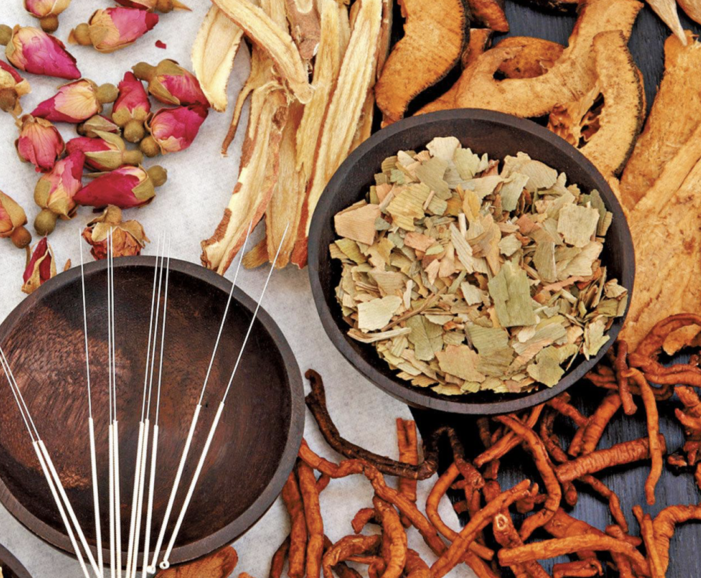 acupuncture for PCOS