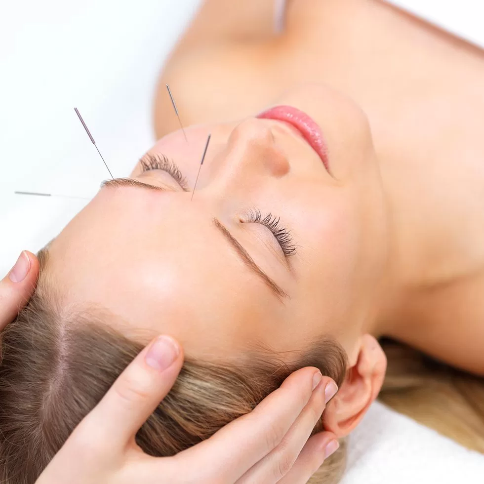 cosmetic acupuncture
