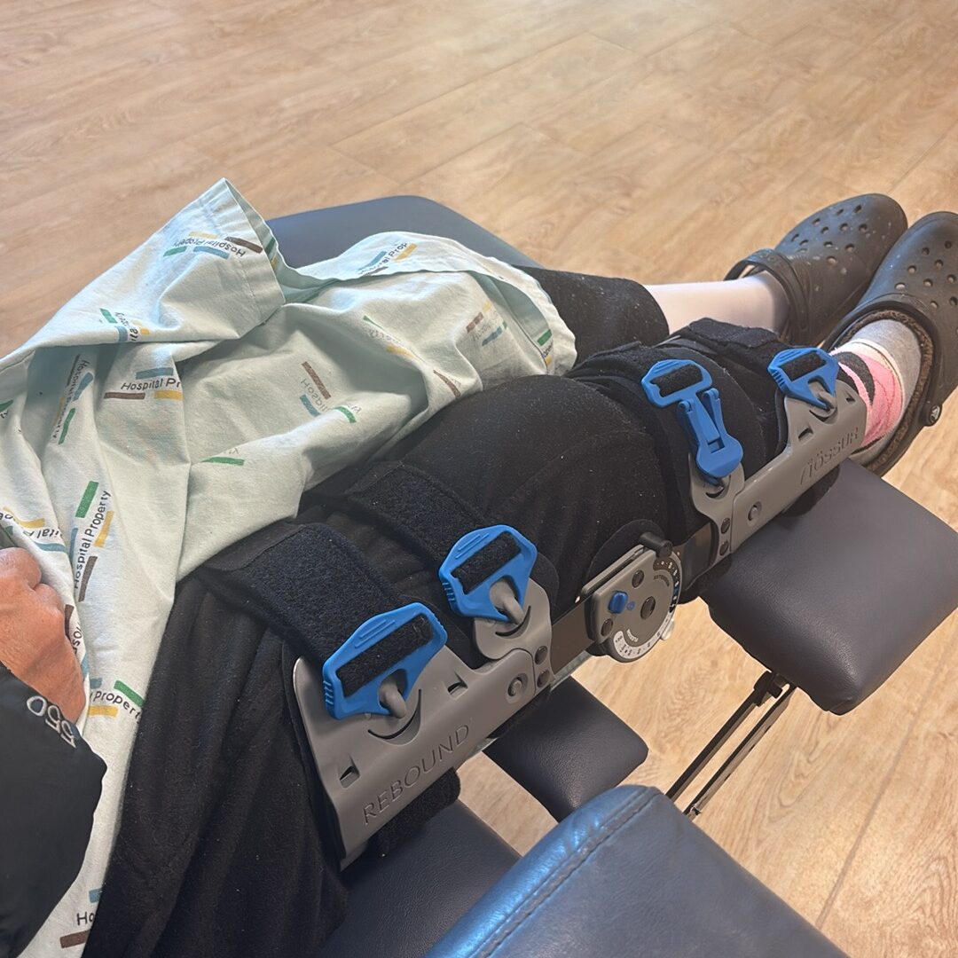 acupuncture for kneecap fracture