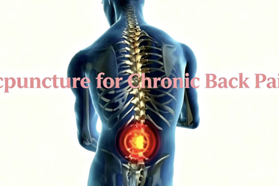 acupuncture for chronic lower back pain
