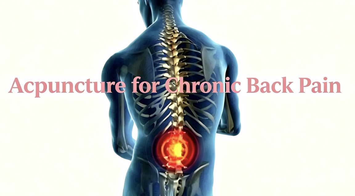 acupuncture for chronic lower back pain